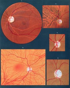 A mikroszkópon keresztül látott szem, az Atlas of Ophthalmoscopy című kiadványból, amelyet Párizsban adtak ki, 1870 (chromolitho) alkotó: Richard Liebreich